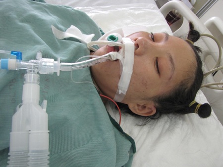 Sau mổ hiện tại chị Ngân đã được chuyển lên khoa Hồi sức tích cực (Hình ảnh chị Ngân ngày 12/6)